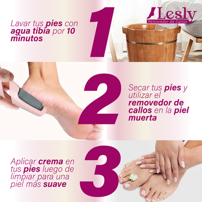 OFERTA SOLO HOY🎁| Removedor de callos y durezas para pies - Lesly™