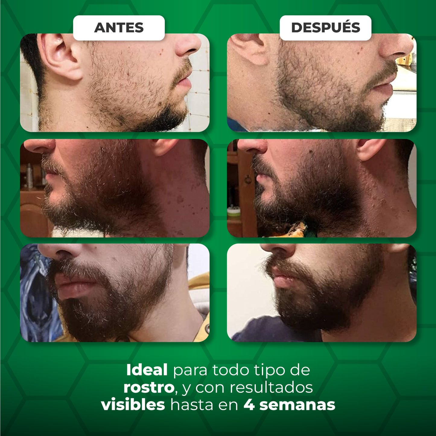 SERUM NATURAL PARA EL CRECIMIENTO DE LA BARBA - GROWT SERUM™