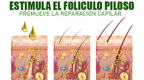 SPRAY PARA ALOPECIA - HyperSpray™