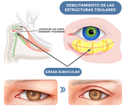 Crema para Ojeras - OpenEyes™