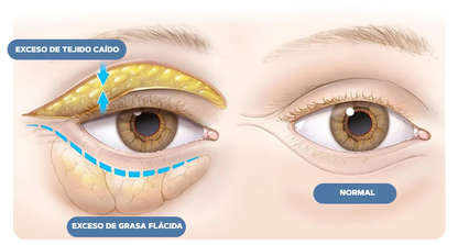 Crema para Ojeras - OpenEyes™